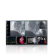 Wielkoformatowy monitor medyczny EIZO RadiForce LS580W