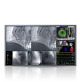Wielkoformatowy monitor medyczny EIZO RadiForce LX600W