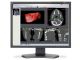 Monitor medyczny NEC MDC212C2