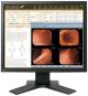Monitor medyczny EIZO RadiForce MX191
