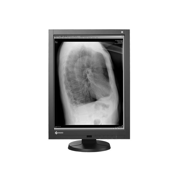 EIZO RadiForce GX340