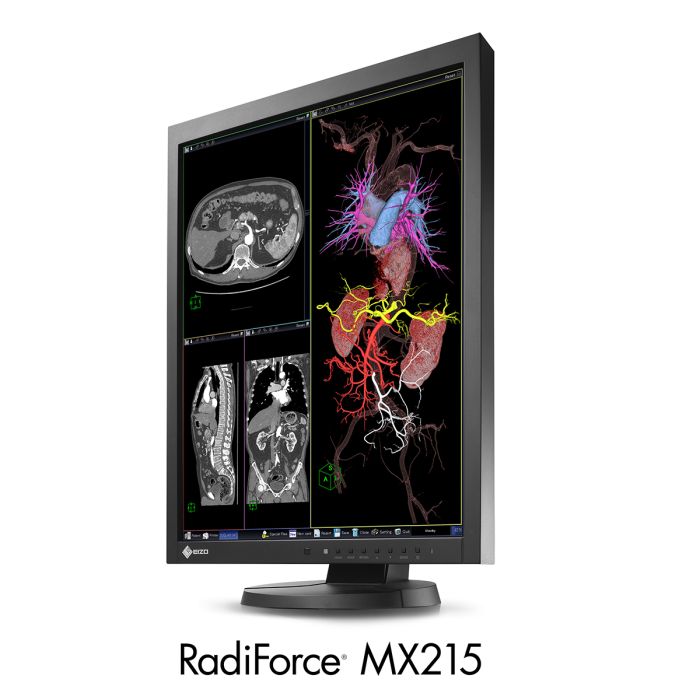 EIZO RadiForce MX215