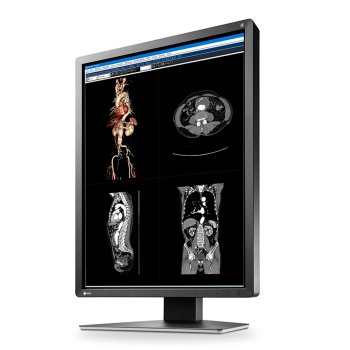 EIZO RadiForce MX216