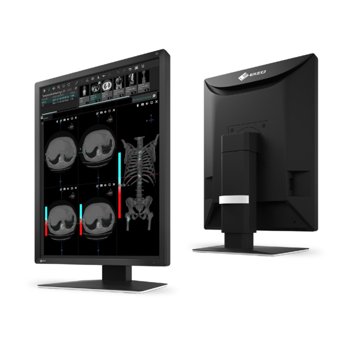 EIZO RadiForce MX217