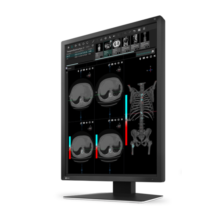 EIZO RadiForce MX217