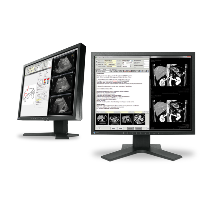 EIZO RadiForce MX194