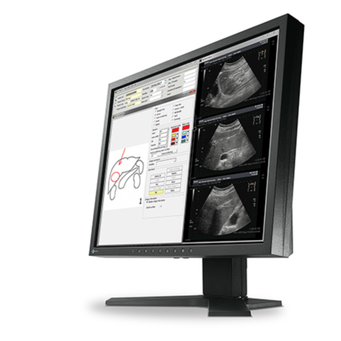 EIZO RadiForce MX194