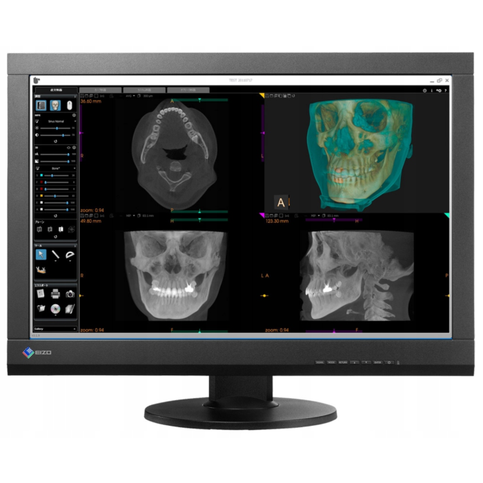 EIZO RadiForce MX242W