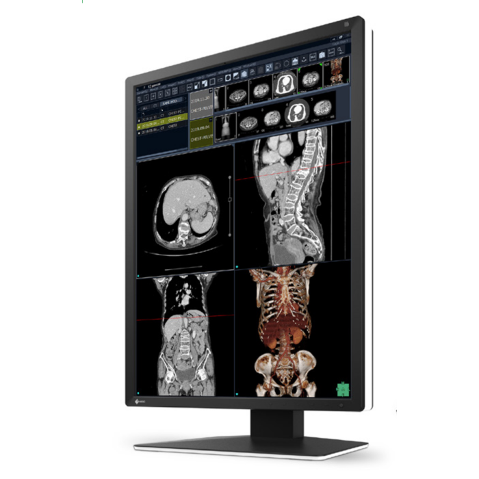 EIZO RadiForce RX270