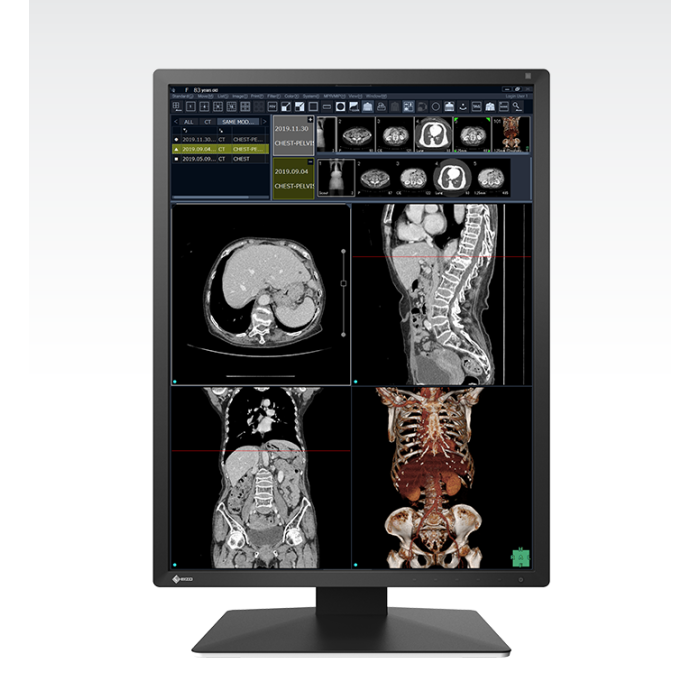 EIZO RadiForce RX270