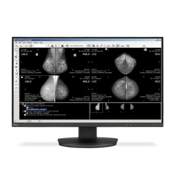 8MP NEC EA271U MedView