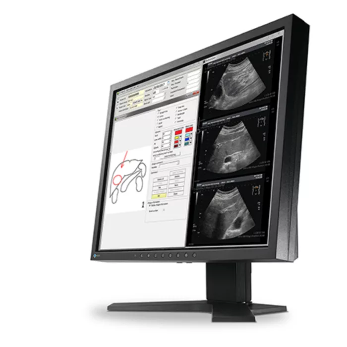 EIZO RadiForce MX194