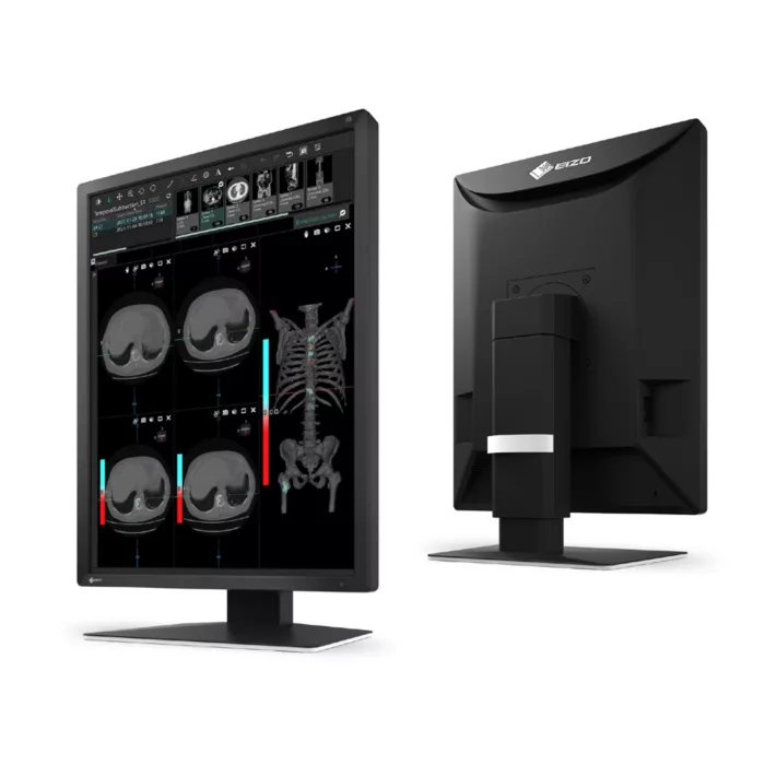 EIZO RadiForce MX217
