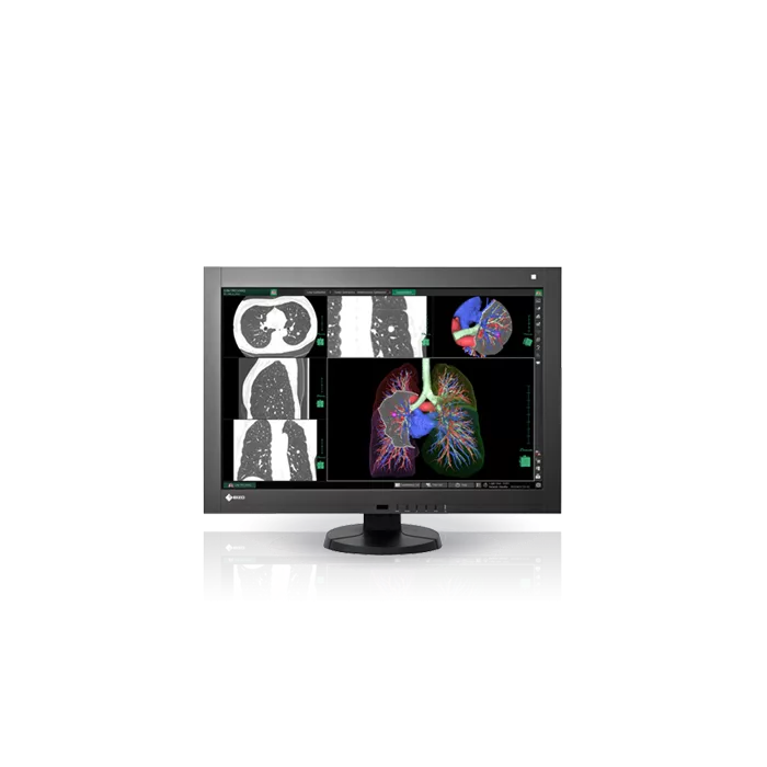 EIZO RadiForce RX440