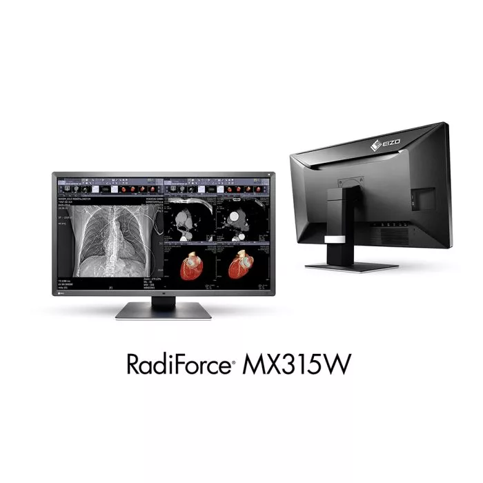 EIZO RadiForce MX315W