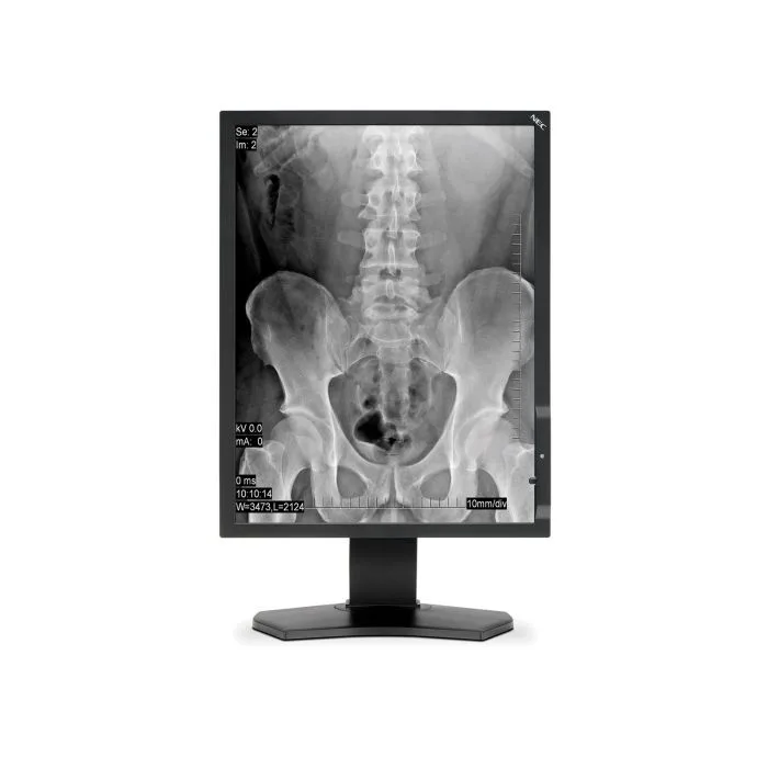 Monitor medyczny NEC MD211G3 - Parowany