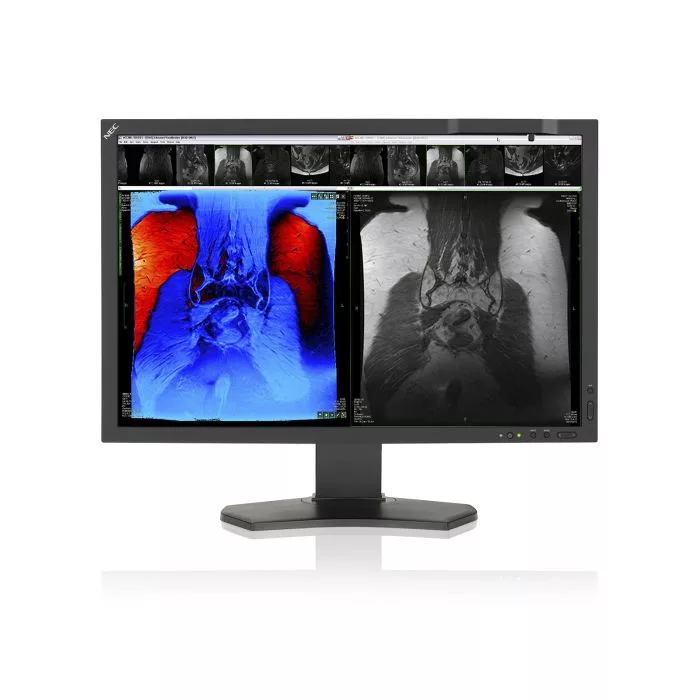 Monitor medyczny NEC MD242C2