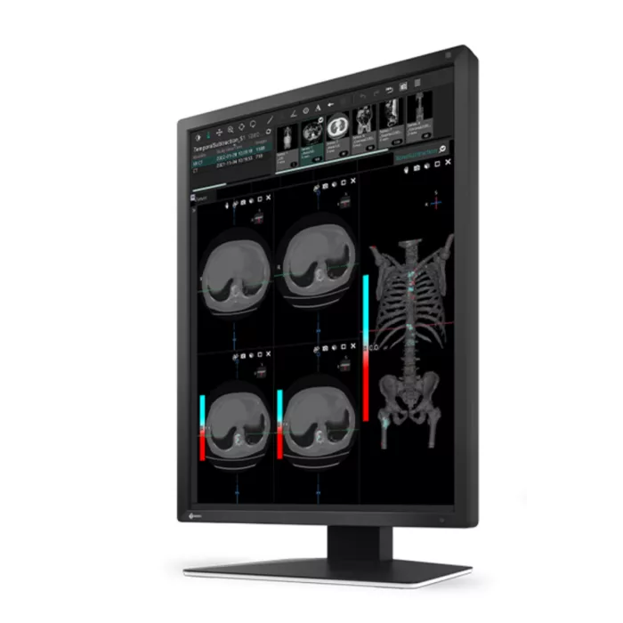 EIZO RadiForce MX217