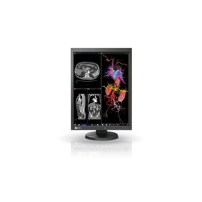 EIZO RadiForce MX215