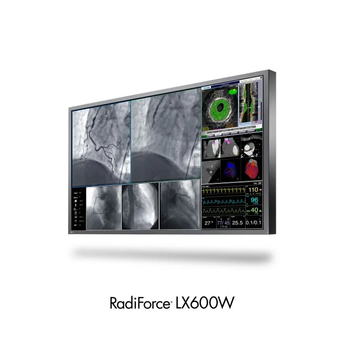 Wielkoformatowy monitor medyczny EIZO RadiForce LX600W