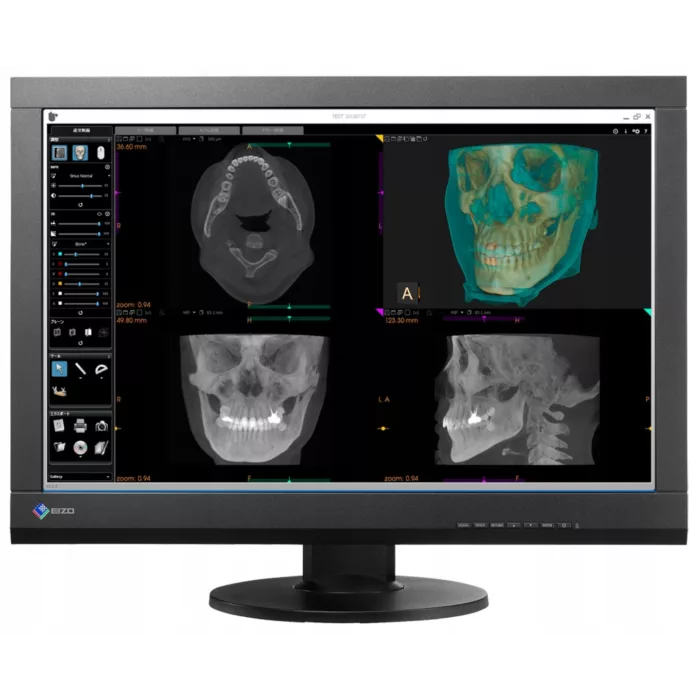 EIZO RadiForce MX242W