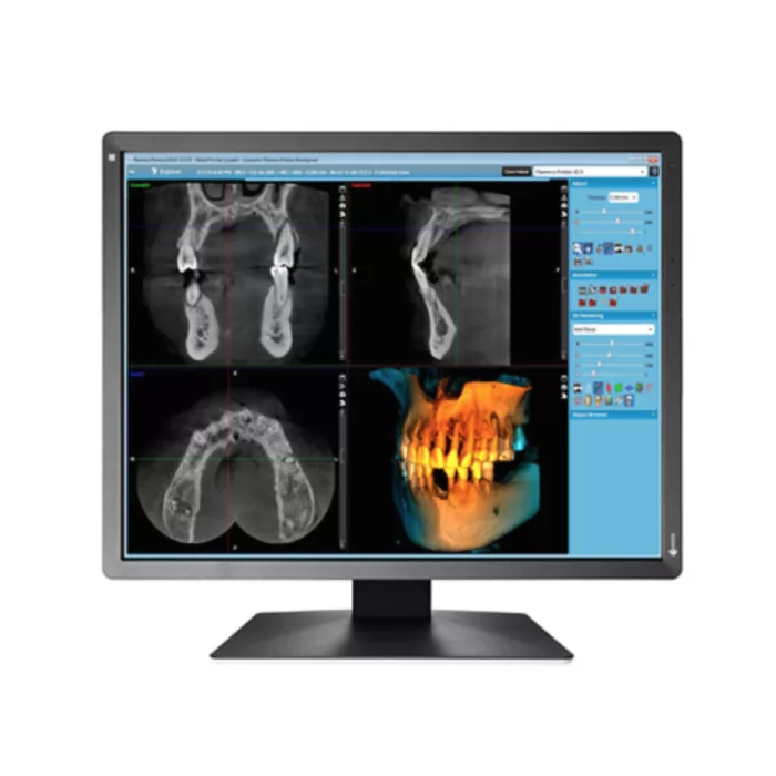 EIZO RadiForce MX216