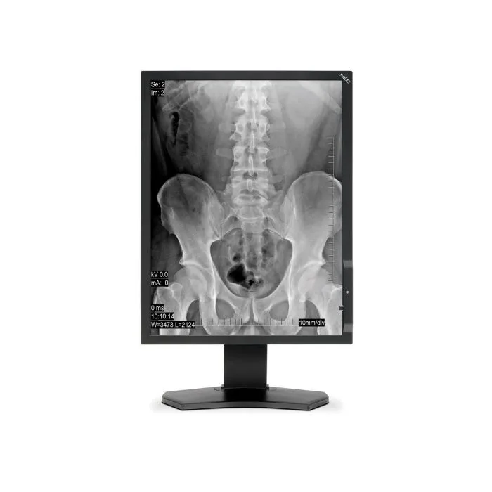 Monitor medyczny NEC MD211G5 - Parowany