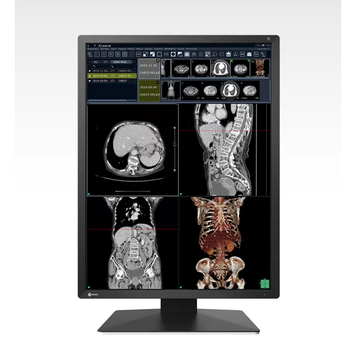 EIZO RadiForce RX270