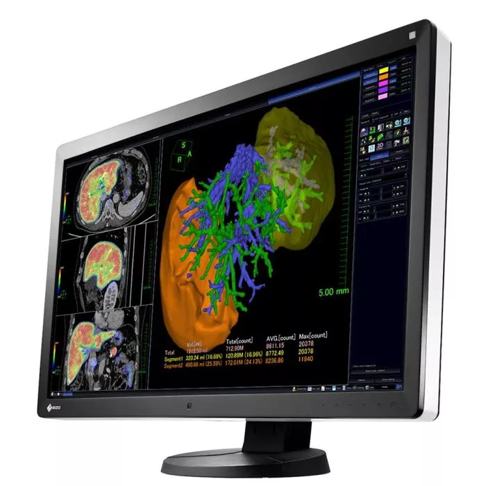EIZO RadiForce RX650
