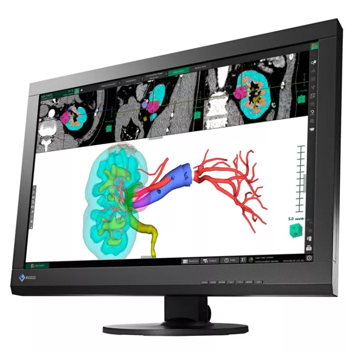 EIZO RadiForce MX242W