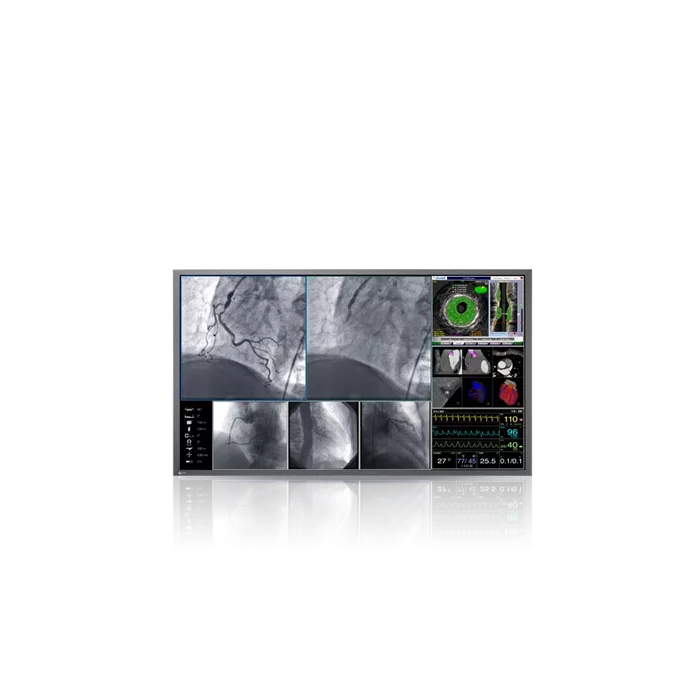 Wielkoformatowy monitor medyczny EIZO RadiForce LX600W