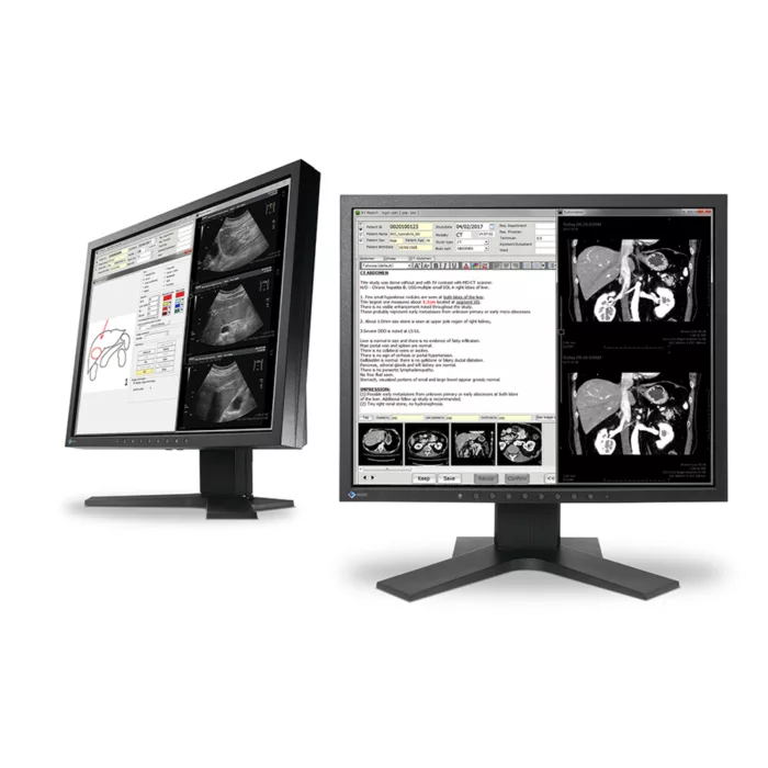 EIZO RadiForce MX194