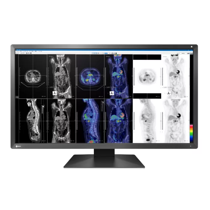 EIZO RadiForce MX317W