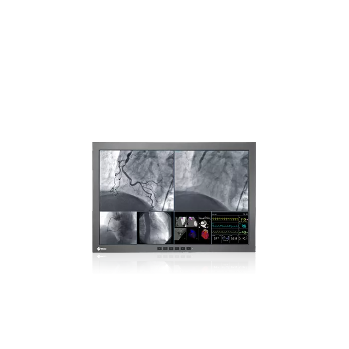 Wielkoformatowy monitor medyczny EIZO RadiForce LX300W