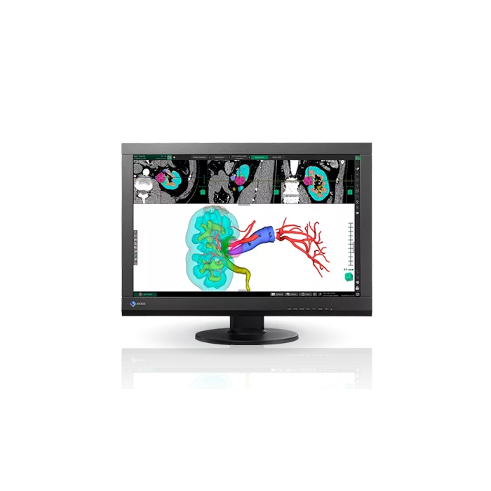 EIZO RadiForce MX242W