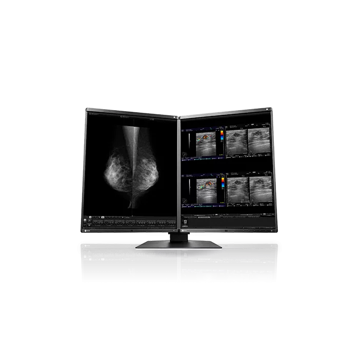 EIZO RadiForce RX560