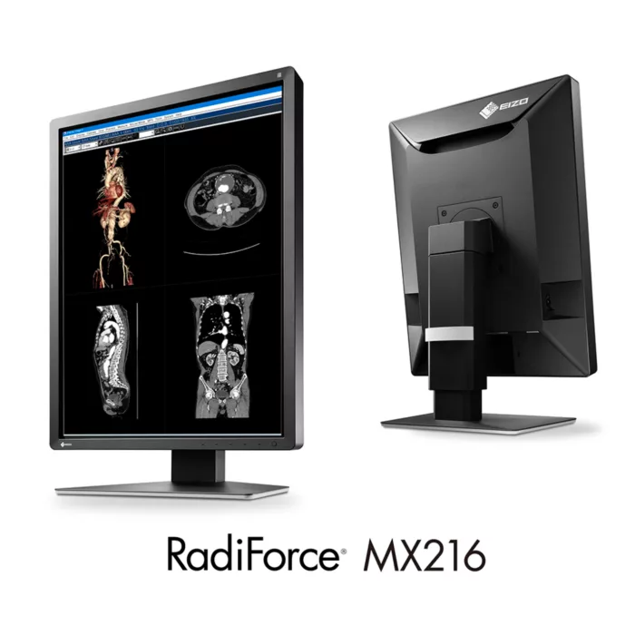 EIZO RadiForce MX216