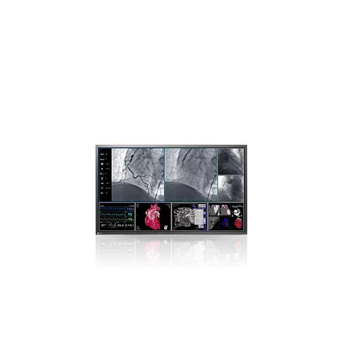Wielkoformatowy monitor medyczny EIZO RadiForce LS580W