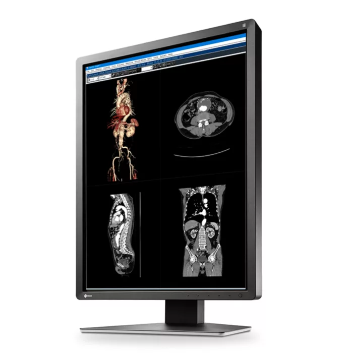 EIZO RadiForce MX216