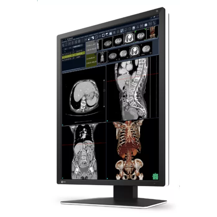 EIZO RadiForce RX270