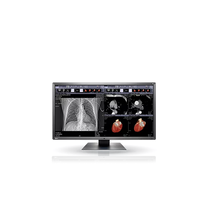 EIZO RadiForce MX315W