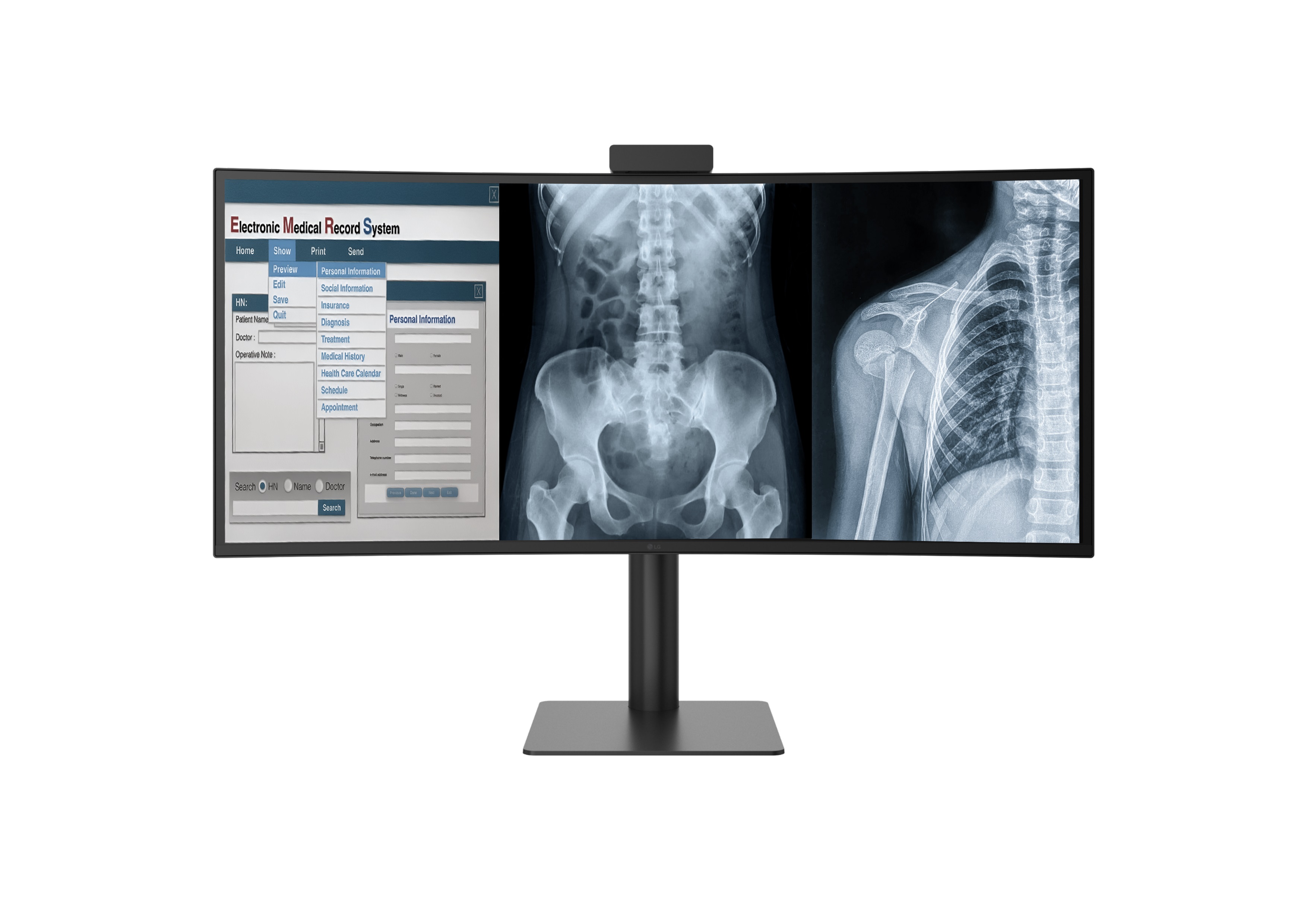 LG 40HT513D curved diagnostic monitor displaying medical record software beside two X-ray images