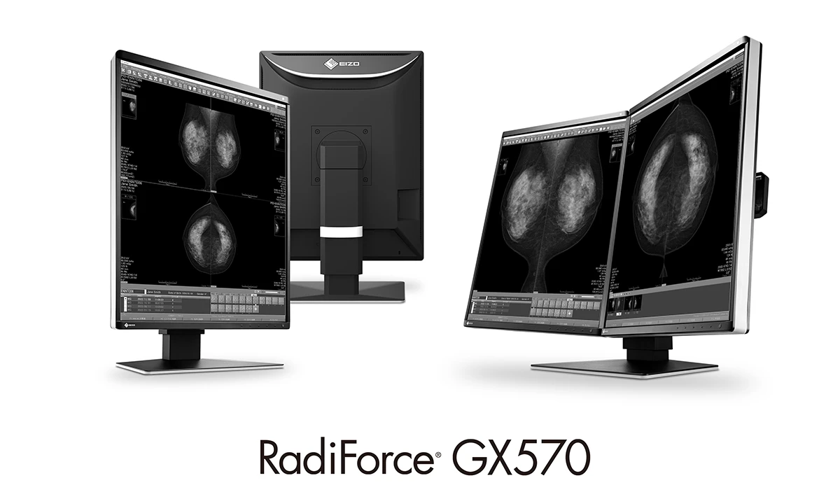 EIZO RadiForce GX570 single-screen and MammoDuo configurations in the original manufacturer press image.