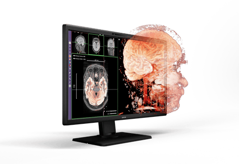 Barco promotional rendering of the Eonis 3D monitor, illustrating a head model with simulated depth extending beyond the screen.